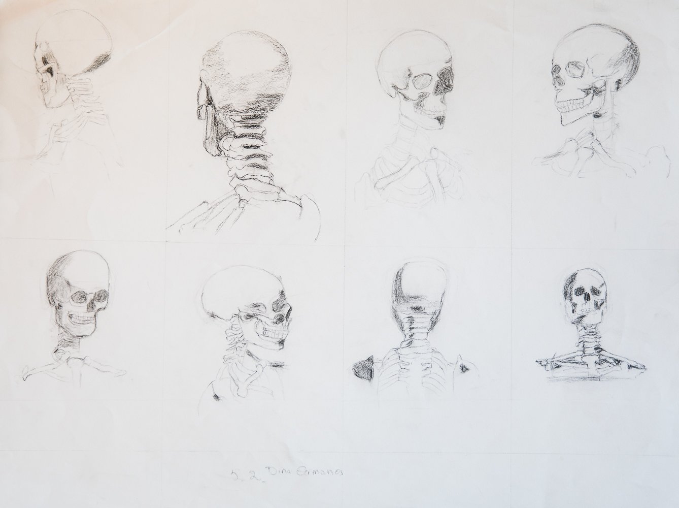 Bone Architecture: The Skull